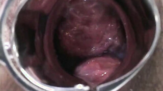 Hot Preggy Babe with male nurses & doc love to suck cocks.